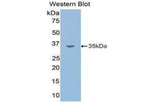 Western Blotting (WB) image for anti-Lipolysis Stimulated Lipoprotein Receptor (LSR) (AA 335-589) antibody (ABIN1859717) (LSR Antikörper  (AA 335-589))