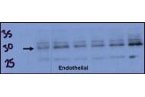 Endothelial cell lysate transferred to membrane was incubated with primary antibody at a 1:500 dilution in 2% BSA in TBST at 4 deg C overnight. (RCAN1 Antikörper  (AA 75-104))