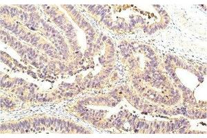 Immunohistochemistry of paraffin-embedded Human colon tissue using STAT1 Monoclonal Antibody at dilution of 1:200.