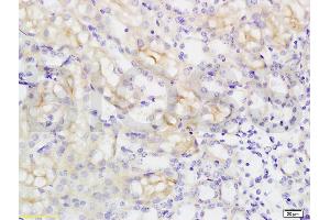 Formalin-fixed and paraffin embedded rat kidney tissue labeled with Anti-SLC16A3 Polyclonal Antibody, Unconjugated (ABIN749303) at 1:200 followed by conjugation to the secondary antibody and DAB staining