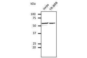 Anti-EEAI Ab at 1/500 dilution, Rabbit polyclonal to goat lµg (HRP) at 1/10,000 dilution, (PDIA3 Antikörper  (C-Term))