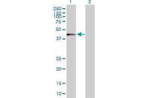 Western Blot analysis of ZNF584 expression in transfected 293T cell line by ZNF584 MaxPab polyclonal antibody. (ZNF584 Antikörper  (AA 1-421))