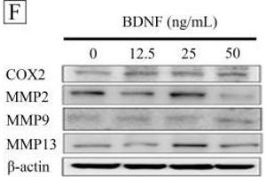 Western Blotting (WB) image for anti-Matrix Metallopeptidase 13 (Collagenase 3) (MMP13) antibody (ABIN2854829)