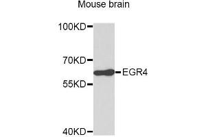 Western blot analysis of extracts of Mouse brain cells, using EGR4 antibody.