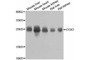Western blot analysis of extracts of various cell lines, using MT-CO2 antibody (ABIN6294175) at 1:800 dilution. (COX2 Antikörper)