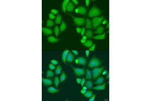Immunofluorescence analysis of U2OS cells using CAPN2 antibody (ABIN2736399) at dilution of 1:100. (Calpain 2 Antikörper)