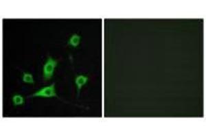 Immunofluorescence analysis of LOVO cells, using CRBP III antibody. (Retinol Binding Protein 5 Antikörper)