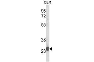 Western blot analysis of C15orf29 Antibody (N-term) in CEM cell line lysates (35µg/lane). (KATNBL1 Antikörper  (N-Term))