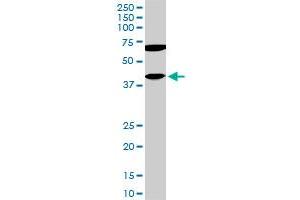 CDX4 monoclonal antibody (M11), clone 2H7. (CDX4 Antikörper  (AA 202-284))