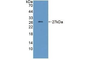 Detection of Recombinant CRP, Human using Monoclonal Antibody to C Reactive Protein (CRP) (CRP Antikörper  (AA 17-224))