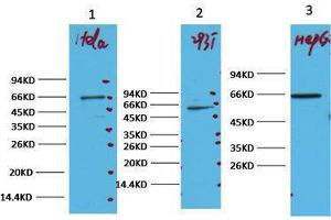 Western Blotting (WB) image for anti-Nuclear Factor-kB p65 (NFkBP65) antibody (ABIN3178606) (NF-kB p65 Antikörper)