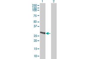 Western Blot analysis of METTL9 expression in transfected 293T cell line ( H00051108-T01 ) by METTL9 MaxPab polyclonal antibody. (METTL9 Antikörper  (AA 1-283))