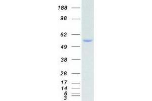 Western Blotting (WB) image for Ribosomal Protein S6 Kinase, 70kDa, Polypeptide 2 (RPS6KB2) protein (Myc-DYKDDDDK Tag) (ABIN2731183)