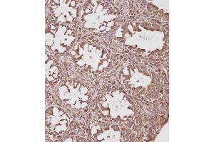 Immunohistochemical analysis of (ABIN391830 and ABIN2841673) on paraffin-embedded Human colon tissue. (HSP70 1A Antikörper  (AA 19-48))