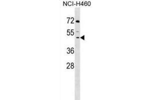 Western Blotting (WB) image for anti-Decapping Enzyme, Scavenger (DCPS) antibody (ABIN2999210) (DCPS Antikörper)