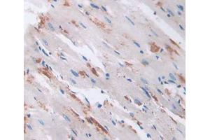 Used in DAB staining on fromalin fixed paraffin- embedded heart tissue (RHAG Antikörper  (AA 251-450))