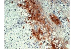 Immunohistochemistry staining of human pituitary gland (frozen sections) with anti-human beta Endorphin (B31. (beta Endorphin Antikörper)