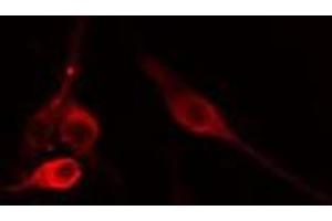 ABIN6275662 staining 293 cells by IF/ICC. (UBAC1 Antikörper  (Internal Region))