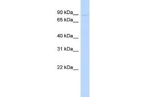 WB Suggested Anti-POSTN Antibody Titration:  1 ug/ml  Positive Control:  721_B cell lysate (Periostin Antikörper  (N-Term))