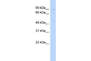 WB Suggested Anti-POSTN Antibody Titration:  1 ug/ml  Positive Control:  721_B cell lysate