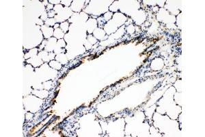 IHC-P: FGFR3 antibody testing of rat lung tissue (FGFR3 Antikörper  (N-Term))