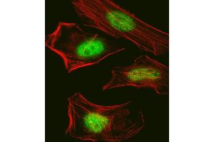 Fluorescent confocal image of Hela cell stained with Pan SUMO Antibody (ABIN388089 and ABIN2846043). (Pan SUMO Antikörper)