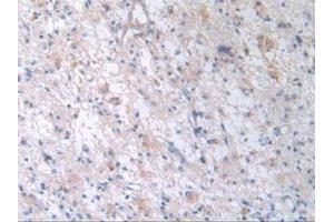 Figure. (TTR Antikörper  (AA 21-147))