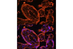 Immunofluorescence analysis of human placenta cells using LDB3 antibody (ABIN6128179, ABIN6143125, ABIN6143126 and ABIN6223347) at dilution of 1:100. (LIM Domain Binding 3 Protein Antikörper  (AA 1-283))