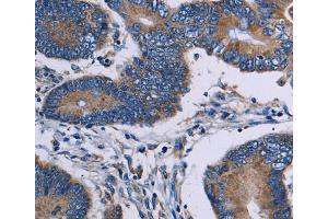 Immunohistochemistry (IHC) image for anti-IL2-Inducible T-Cell Kinase (ITK) antibody (ABIN2430325) (ITK Antikörper)