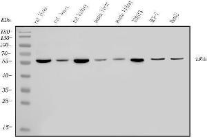 Western blot analysis of ALDH6A1 using anti-ALDH6A1 antibody (ABIN7602810).