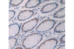 Used in DAB staining on fromalin fixed paraffin- embedded rectum tissue (Ribonuclease A10 (AA 27-216) Antikörper)