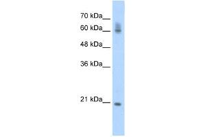 WB Suggested Anti-FIP1L1 Antibody Titration:  0. (FIP1L1 Antikörper  (C-Term))