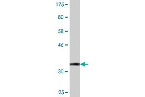 Western Blotting (WB) image for anti-Adenylosuccinate Synthase Like 1 (ADSSL1) (AA 369-436) antibody (ABIN530485)