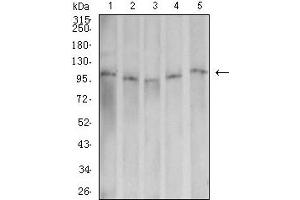 Western Blotting (WB) image for anti-Dynamin 2 (DNM2) (AA 520-744) antibody (ABIN5611153)