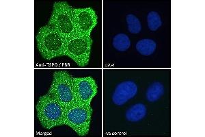 ABIN185697 Immunofluorescence analysis of paraformaldehyde fixed MCF7 cells, permeabilized with 0. (TSPO Antikörper  (C-Term))