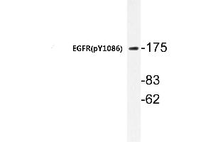 Western blot (WB) analyzes of p-EGFR antibody in extracts from HepG2 cells. (EGFR Antikörper  (pTyr1110))