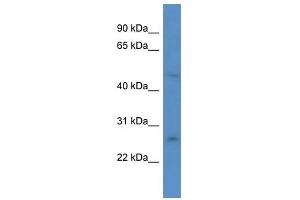 Western Blot showing ANKRD32 antibody used at a concentration of 1. (ANKRD32 Antikörper  (N-Term))