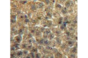 IHC-P analysis of Liver tissue, with DAB staining. (ITIH2 Antikörper  (AA 452-702))