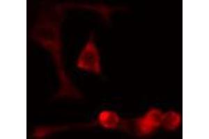 ABIN6274701 staining Hela cells by IF/ICC.