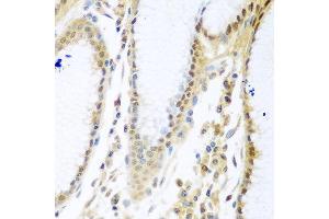 Immunohistochemistry of paraffin-embedded human stomach using MYBBP1A antibody at dilution of 1:100 (40x lens). (MYBBP1A Antikörper)