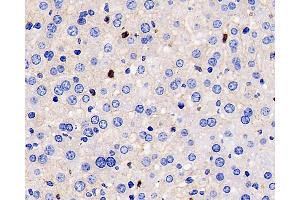 Immunohistochemistry analysis of paraffin-embedded mouse inflammatory liver using MMP9 Monoclonal Antibody at dilution of 1:400.