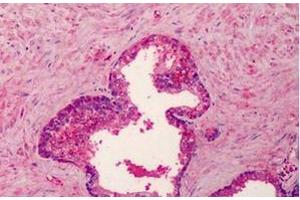 Immunohistochemistry (Paraffin-embedded Sections) (IHC (p)) image for anti-Bone Morphogenetic Protein 4 (BMP4) antibody (ABIN615043)