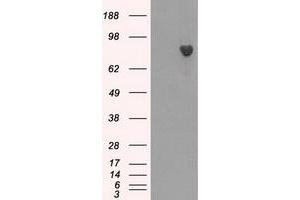 HEK293T cells were transfected with the pCMV6-ENTRY control (Left lane) or pCMV6-ENTRY BTK (Right lane) cDNA for 48 hrs and lysed. (BTK Antikörper)