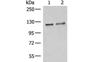 Western blot analysis of K562 cell Human fetal brain tissue lysates using IPO11 Polyclonal Antibody at dilution of 1:500 (Importin 11 Antikörper)
