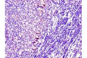 Immunohistochemistry of paraffin-embedded human lymph node tissue using ABIN7170721 at dilution of 1:100 (Stathmin 1 Antikörper  (AA 13-78))