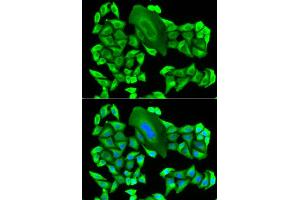 Immunofluorescence analysis of HeLa cell using MTAP antibody. (MTAP Antikörper)