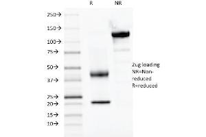 SDS-PAGE Analysis Purified PAX2, Monoclonal Antibody (PAX2/1104).