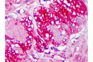 Anti-TRPV3 antibody IHC of human colon, ganglion.