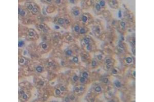 Immunohistochemistry (IHC) image for anti-serpin Peptidase Inhibitor, Clade A (Alpha-1 Antiproteinase, Antitrypsin), Member 6 (SERPINA6) (AA 280-405) antibody (ABIN1174372)