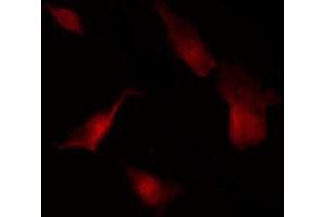 ABIN6269351 staining Hela by IF/ICC. (eIF4EBP1 Antikörper  (Internal Region))